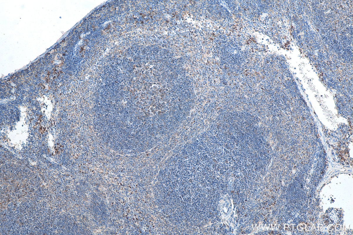 Immunohistochemistry (IHC) staining of mouse spleen tissue using CXCR4 Polyclonal antibody (11073-2-AP)