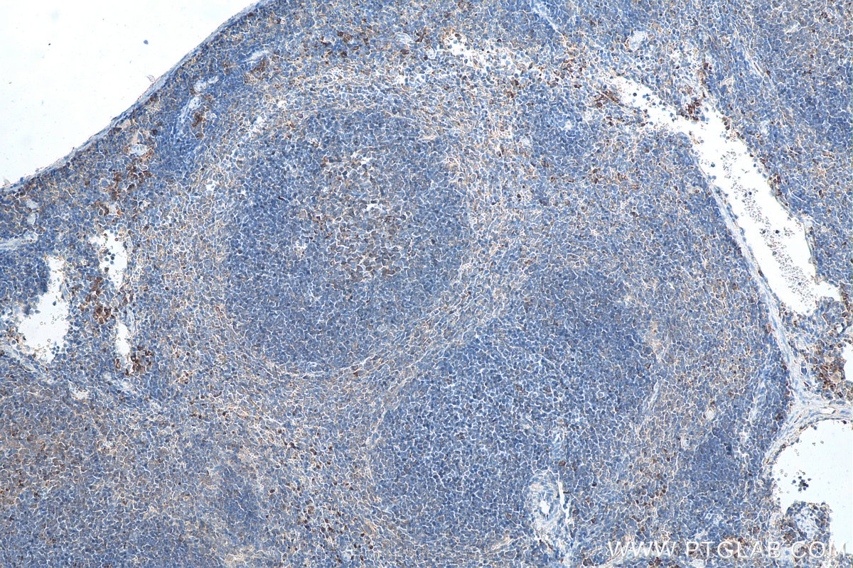 IHC staining of mouse spleen using 11073-2-AP