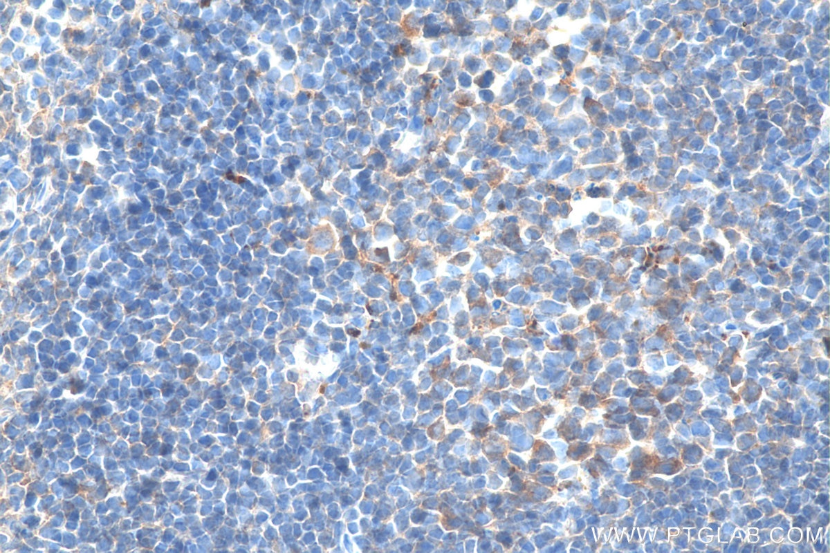 Immunohistochemistry (IHC) staining of mouse spleen tissue using CXCR4 Polyclonal antibody (11073-2-AP)