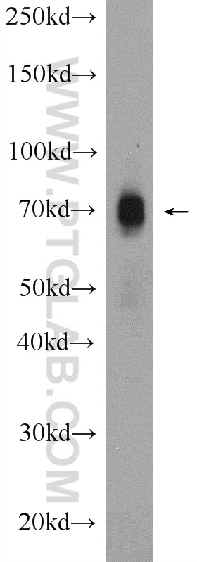 Western Blot (WB) analysis of rat spleen tissue using CXCR4 Polyclonal antibody (11073-2-AP)