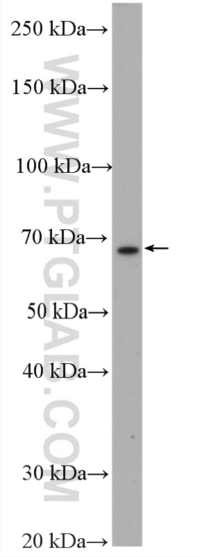 WB analysis of mouse spleen using 11073-2-AP