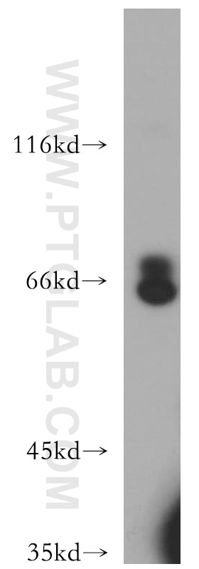 Western Blot (WB) analysis of Jurkat cells using CXCR4 Polyclonal antibody (11073-2-AP)