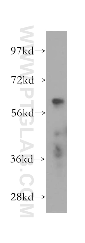 Western Blot (WB) analysis of HeLa cells using CXCR4 Polyclonal antibody (11073-2-AP)