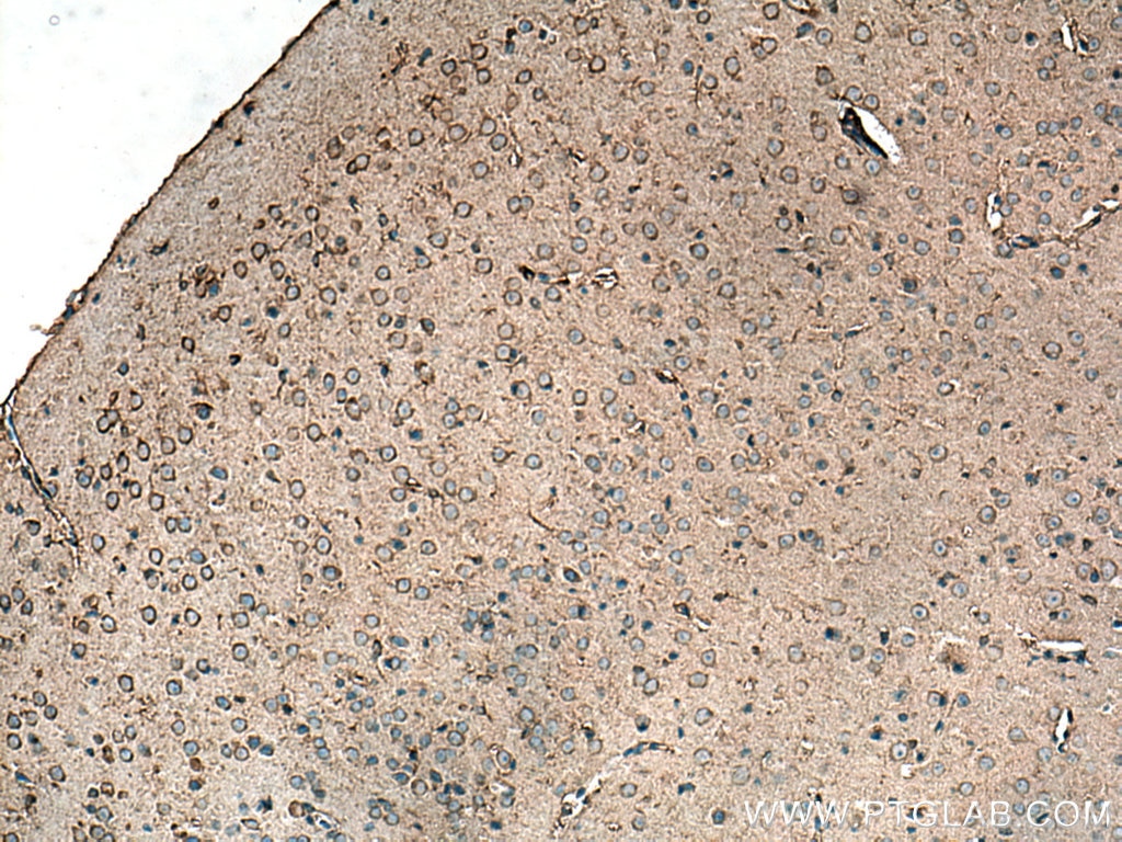 Immunohistochemistry (IHC) staining of mouse brain tissue using CXCR4 Monoclonal antibody (60042-1-Ig)