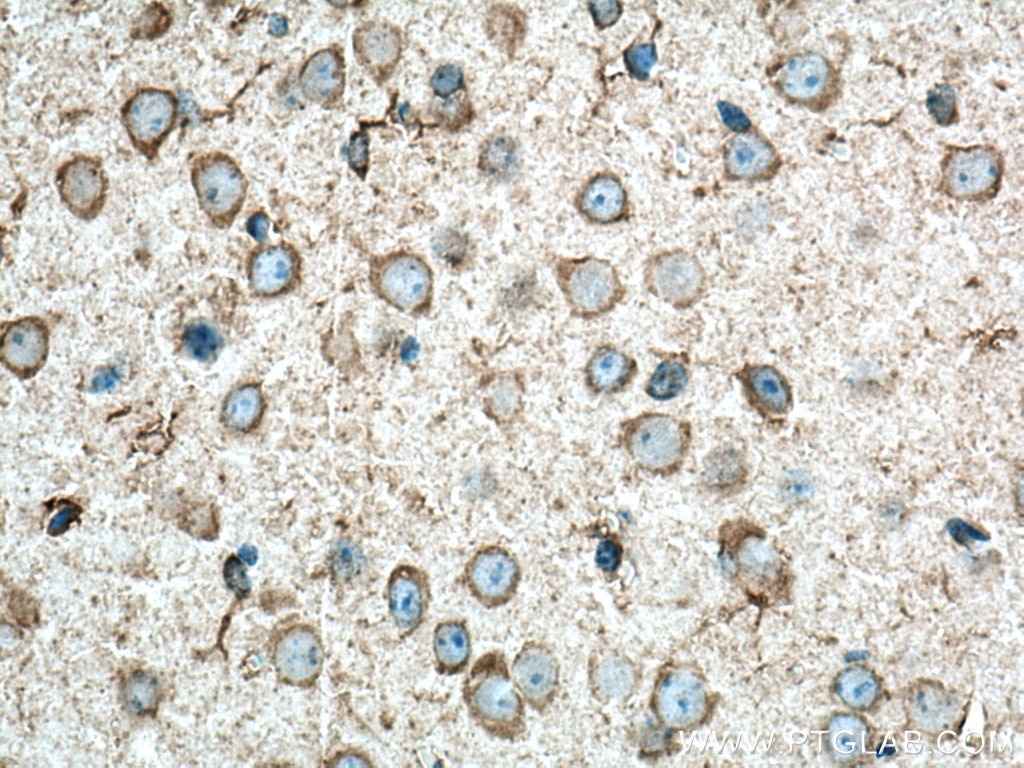 Immunohistochemistry (IHC) staining of mouse brain tissue using CXCR4 Monoclonal antibody (60042-1-Ig)