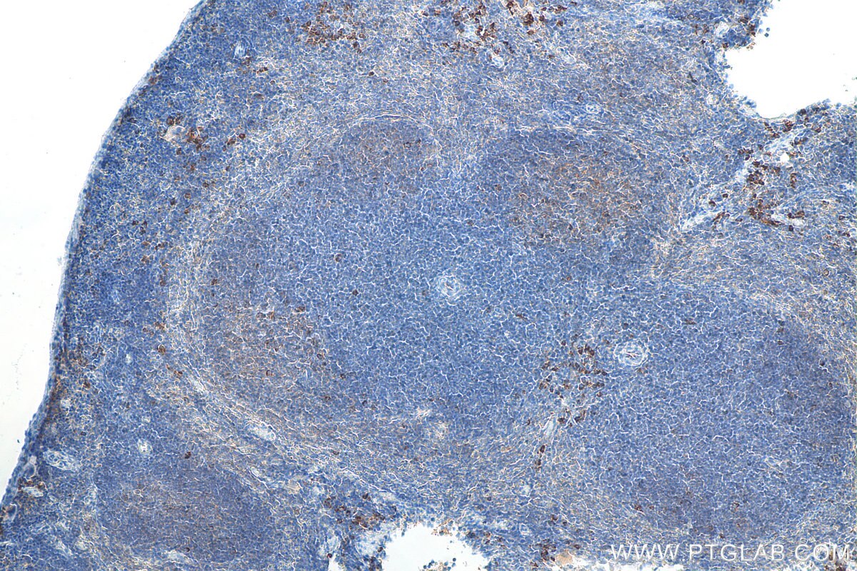 Immunohistochemistry (IHC) staining of mouse spleen tissue using CXCR4 Monoclonal antibody (60042-1-Ig)