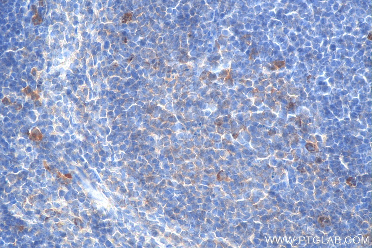 Immunohistochemistry (IHC) staining of mouse spleen tissue using CXCR4 Monoclonal antibody (60042-1-Ig)