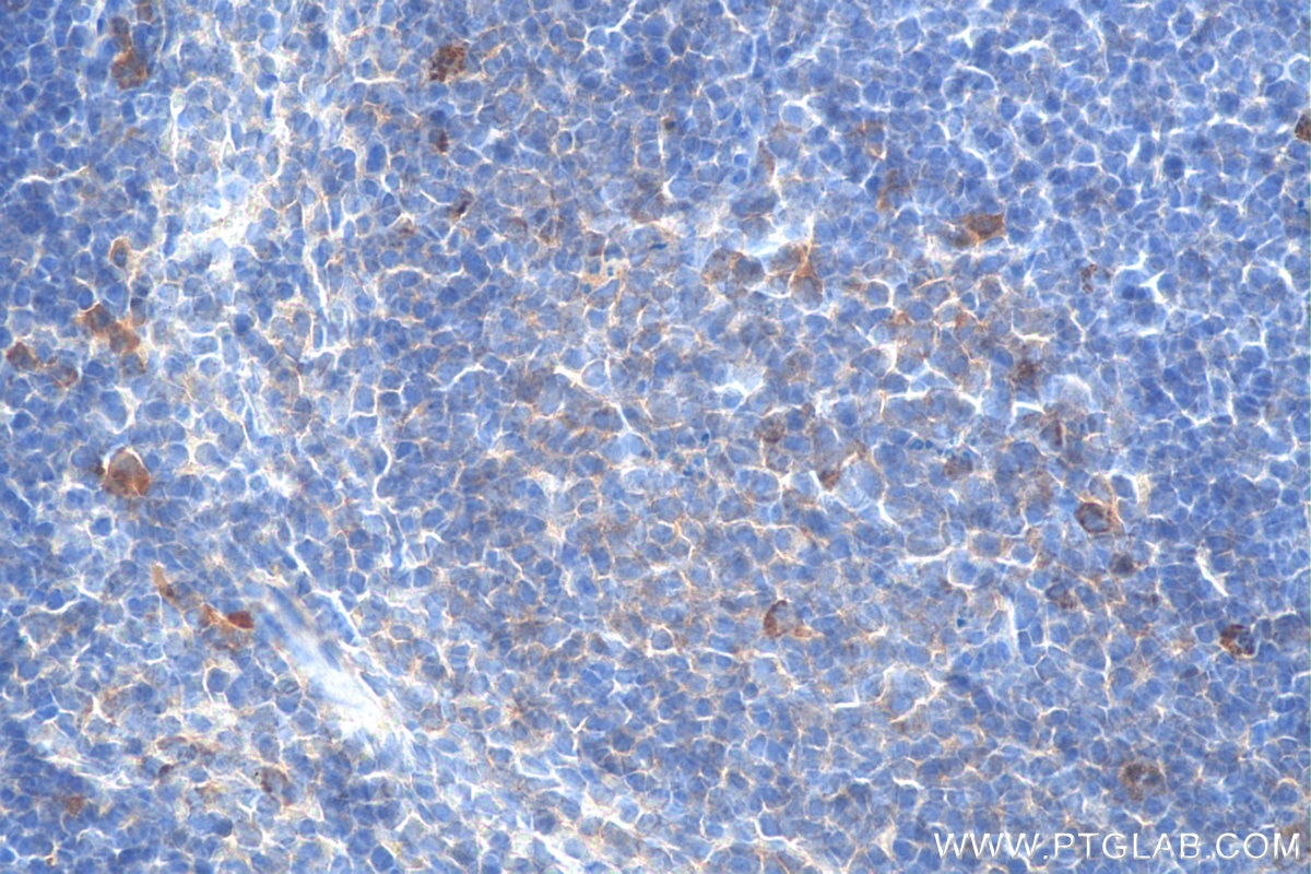 IHC staining of mouse spleen using 60042-1-Ig