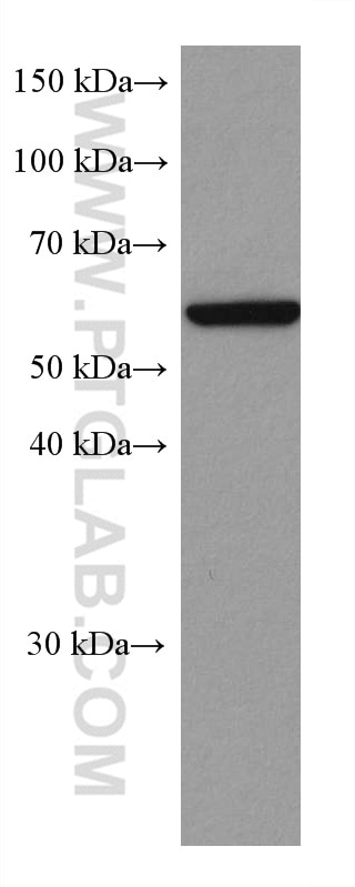 WB analysis of Daudi using 60042-1-Ig