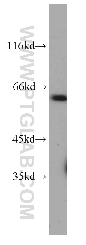 CXCR4 Monoclonal antibody