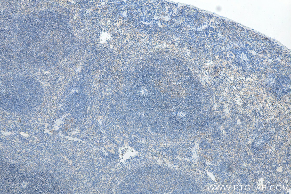 Immunohistochemistry (IHC) staining of mouse spleen tissue using Biotin-conjugated CXCR4 Polyclonal antibody (Biotin-11073)