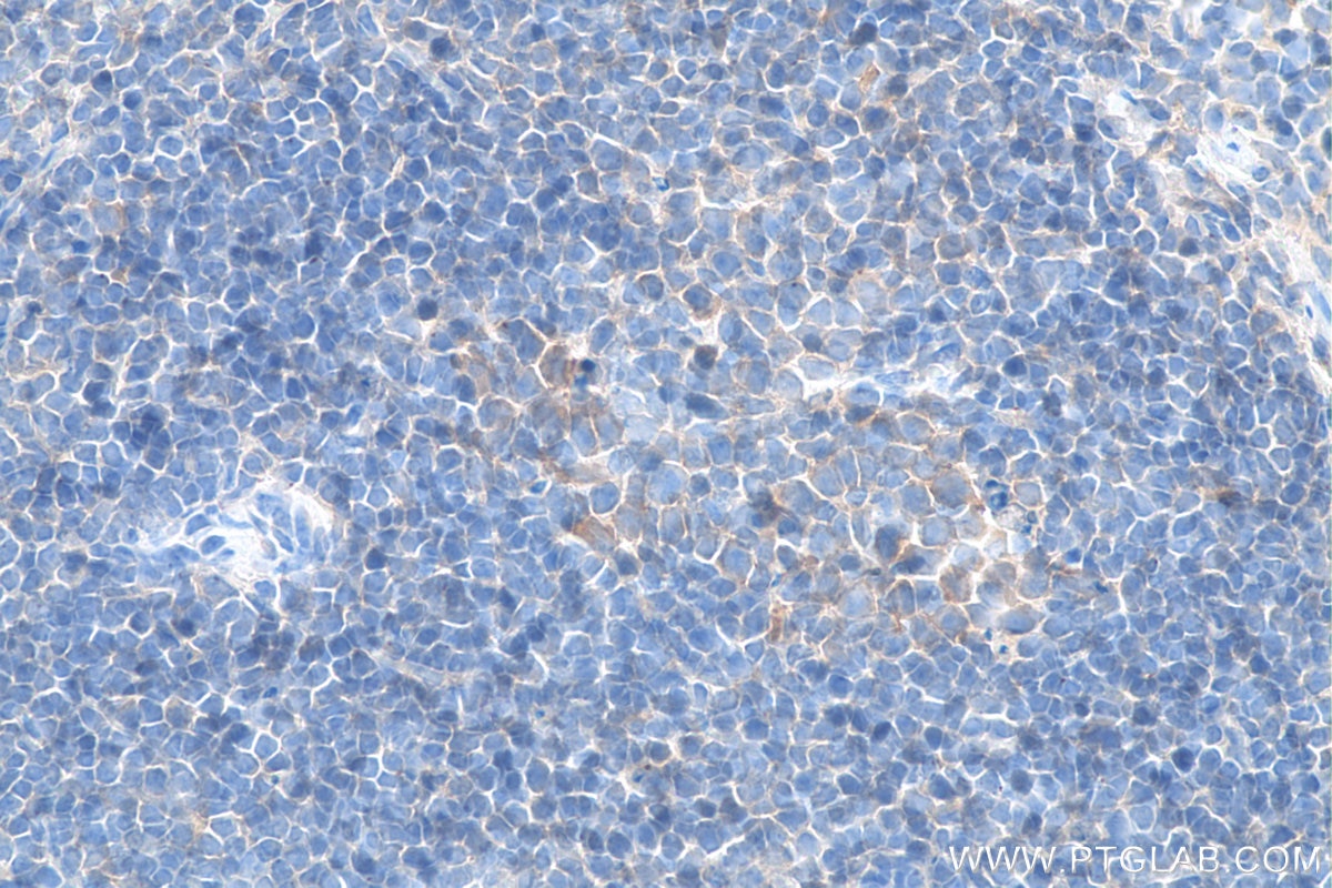 Immunohistochemistry (IHC) staining of mouse spleen tissue using Biotin-conjugated CXCR4 Polyclonal antibody (Biotin-11073)
