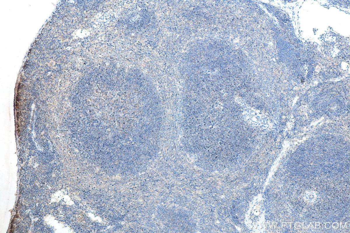 Immunohistochemistry (IHC) staining of mouse spleen tissue using Biotin-conjugated CXCR4 Monoclonal antibody (Biotin-60042)