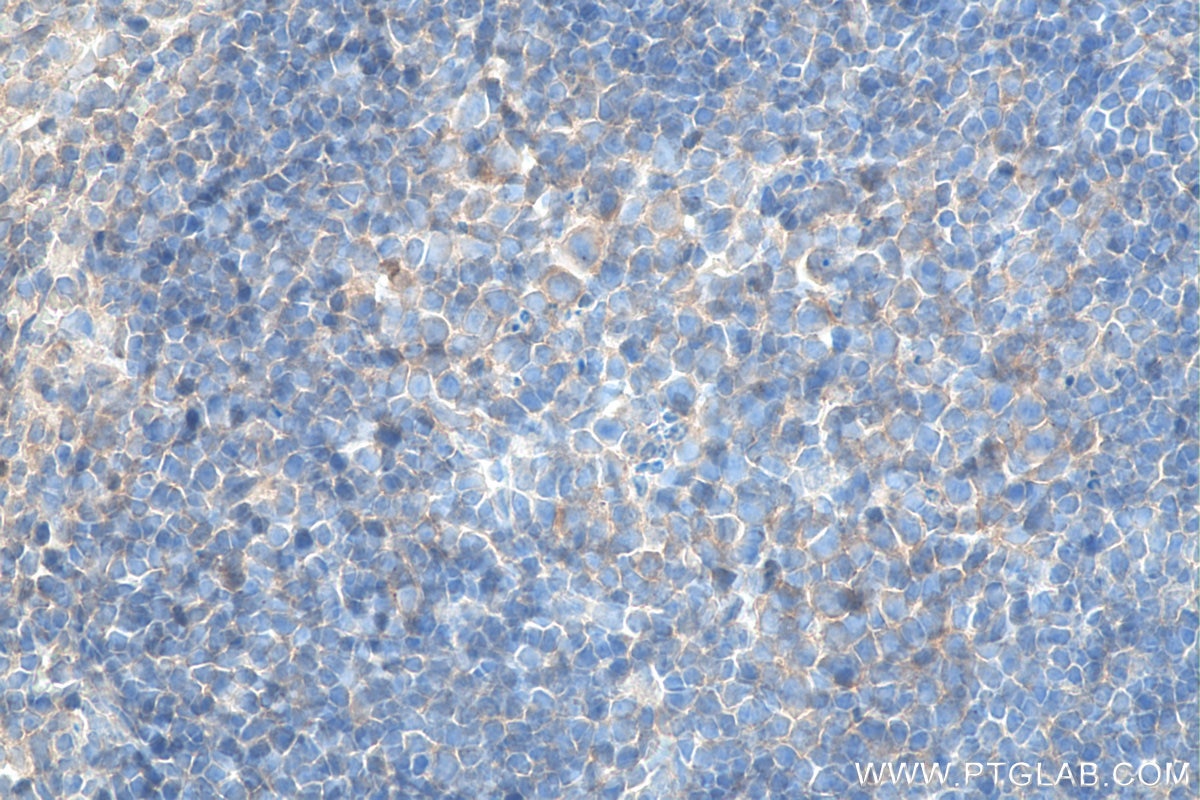 Immunohistochemistry (IHC) staining of mouse spleen tissue using Biotin-conjugated CXCR4 Monoclonal antibody (Biotin-60042)