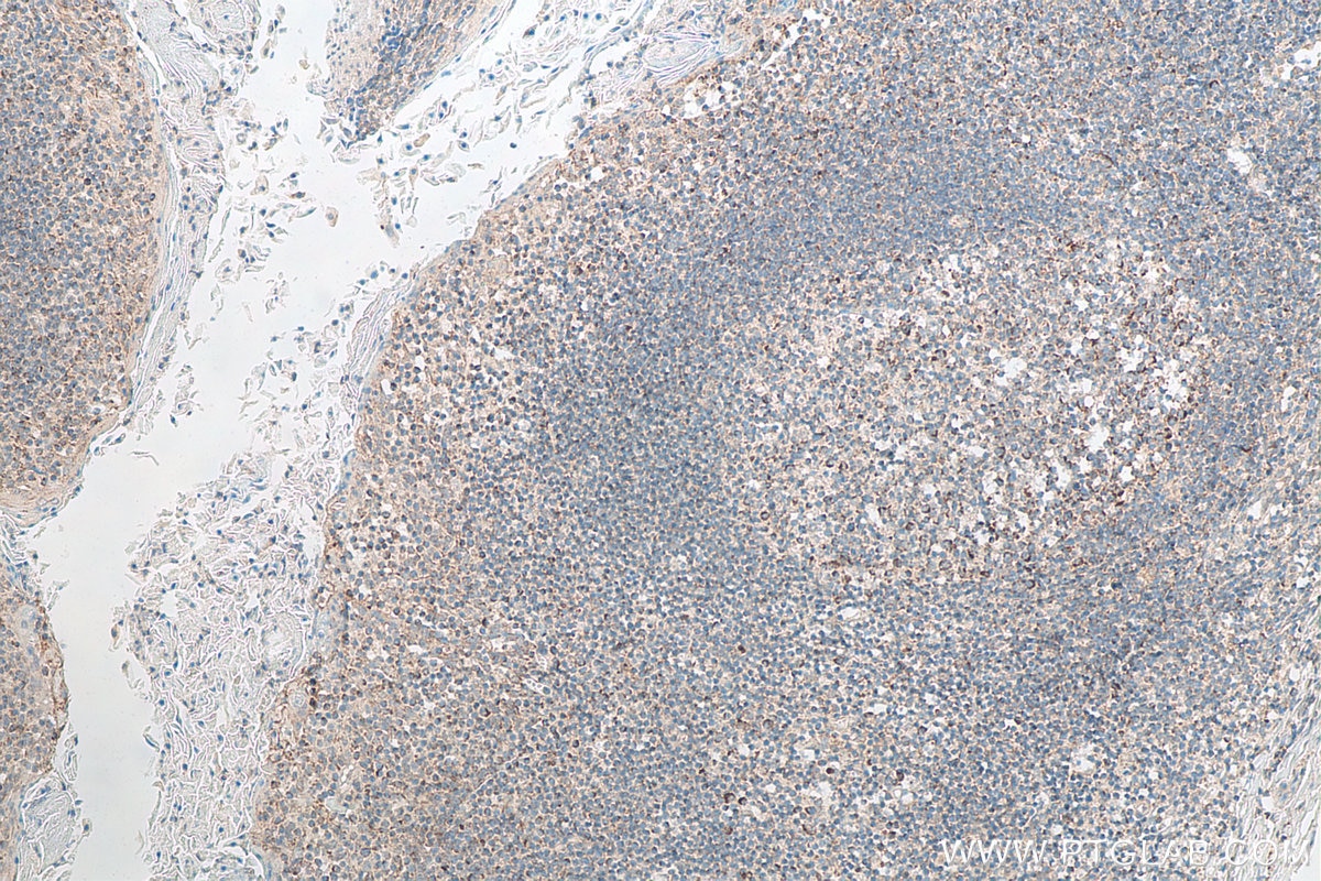 Immunohistochemistry (IHC) staining of human tonsillitis tissue using Biotin-conjugated CXCR4 Monoclonal antibody (Biotin-60042)