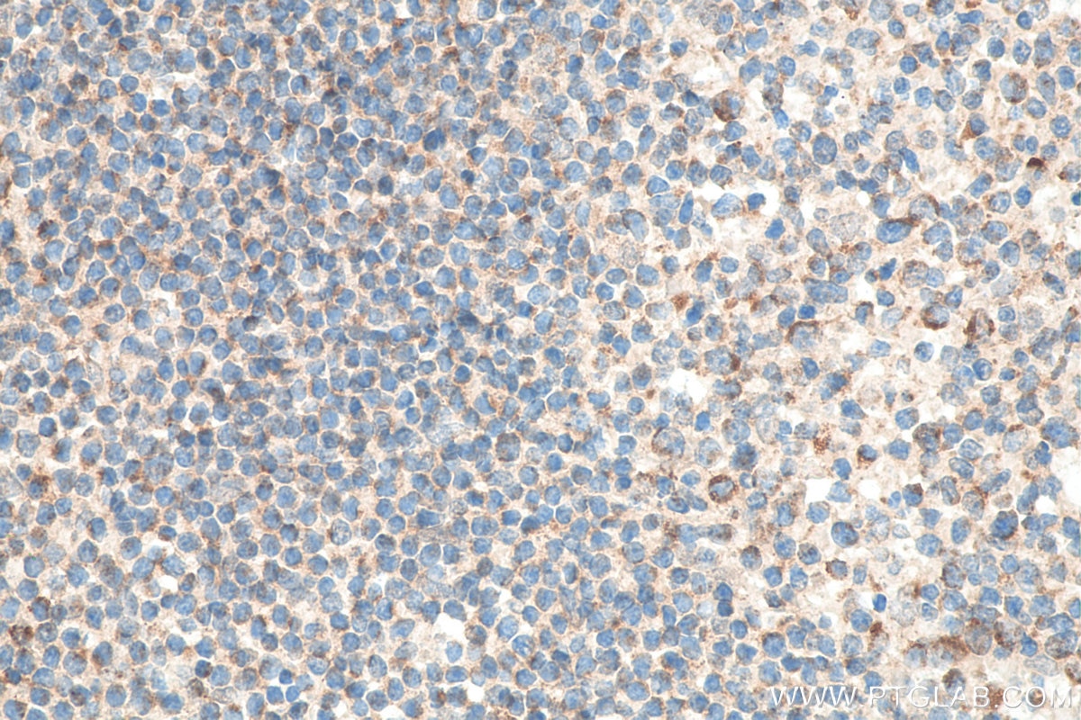 Immunohistochemistry (IHC) staining of human tonsillitis tissue using Biotin-conjugated CXCR4 Monoclonal antibody (Biotin-60042)