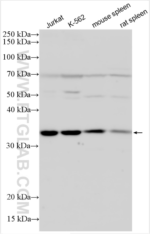 Western Blot (WB) analysis of various lysates using CXCR5 Polyclonal antibody (28239-1-AP)
