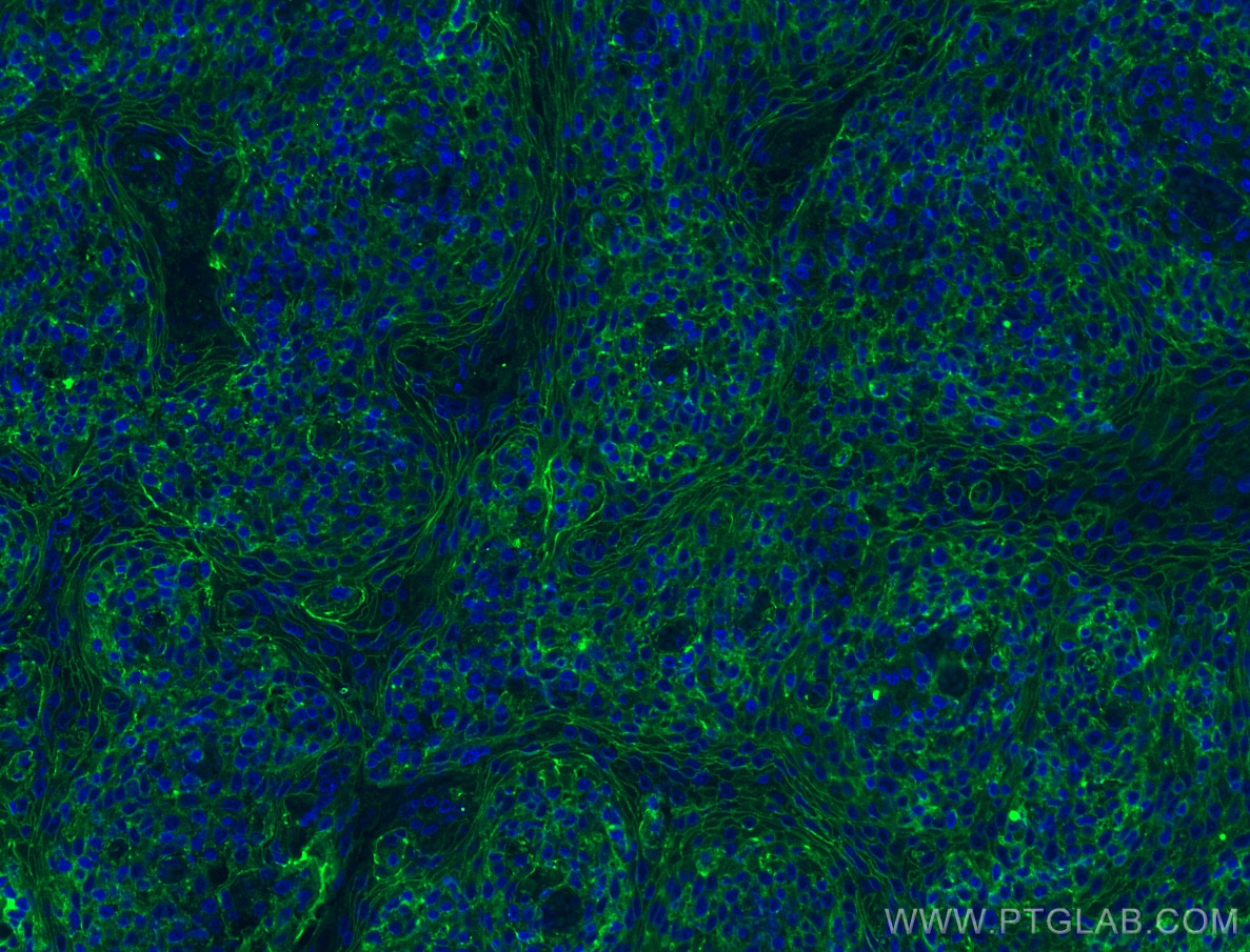 Immunofluorescence (IF) / fluorescent staining of human tonsillitis tissue using CXCR6 Recombinant antibody (84591-1-RR)