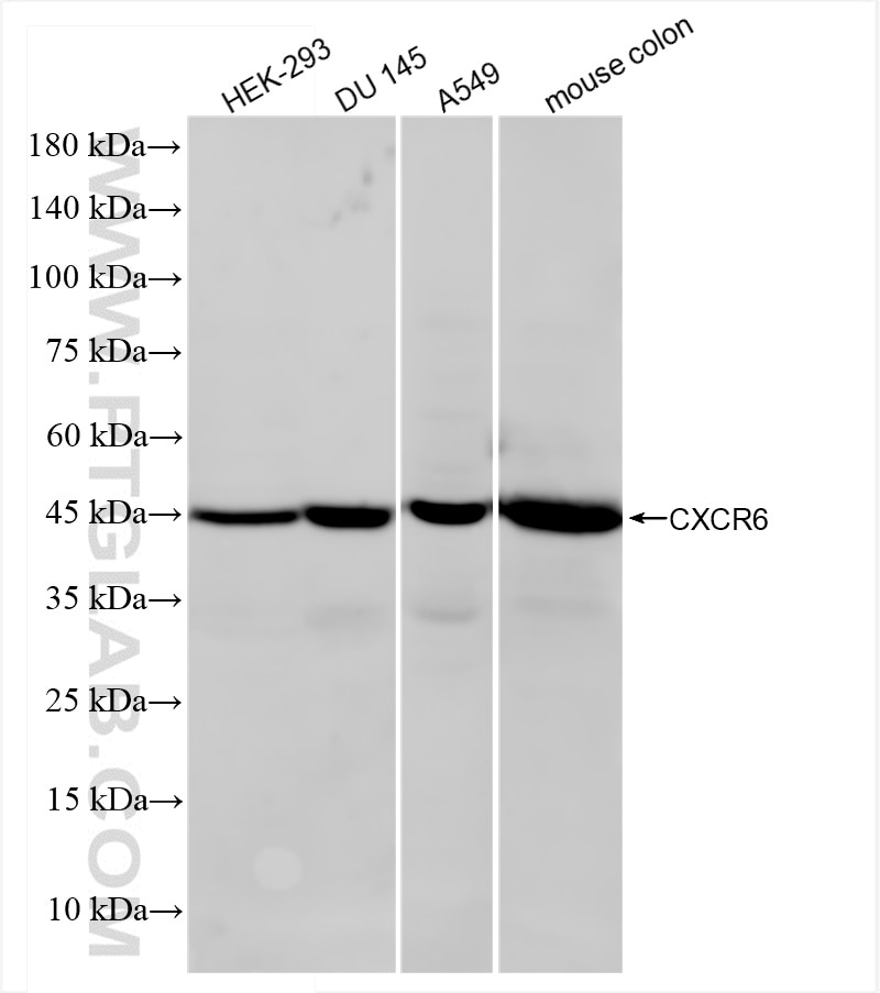 Western Blot (WB) analysis of various lysates using CXCR6 Recombinant antibody (84591-1-RR)
