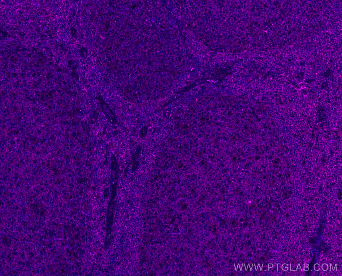 Immunofluorescence (IF) / fluorescent staining of human tonsillitis tissue using APC-conjugated CXCR6 Recombinant antibody (APC-84591)