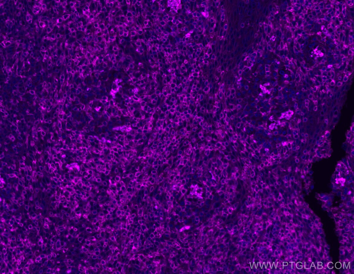 Immunofluorescence (IF) / fluorescent staining of human tonsillitis tissue using APC-conjugated CXCR6 Recombinant antibody (APC-84591)