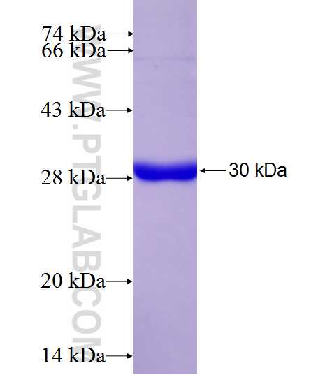 CXCR6 fusion protein Ag27239 SDS-PAGE