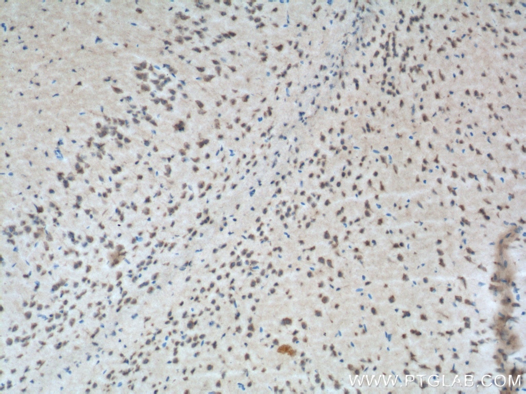 IHC staining of mouse brain using 20423-1-AP