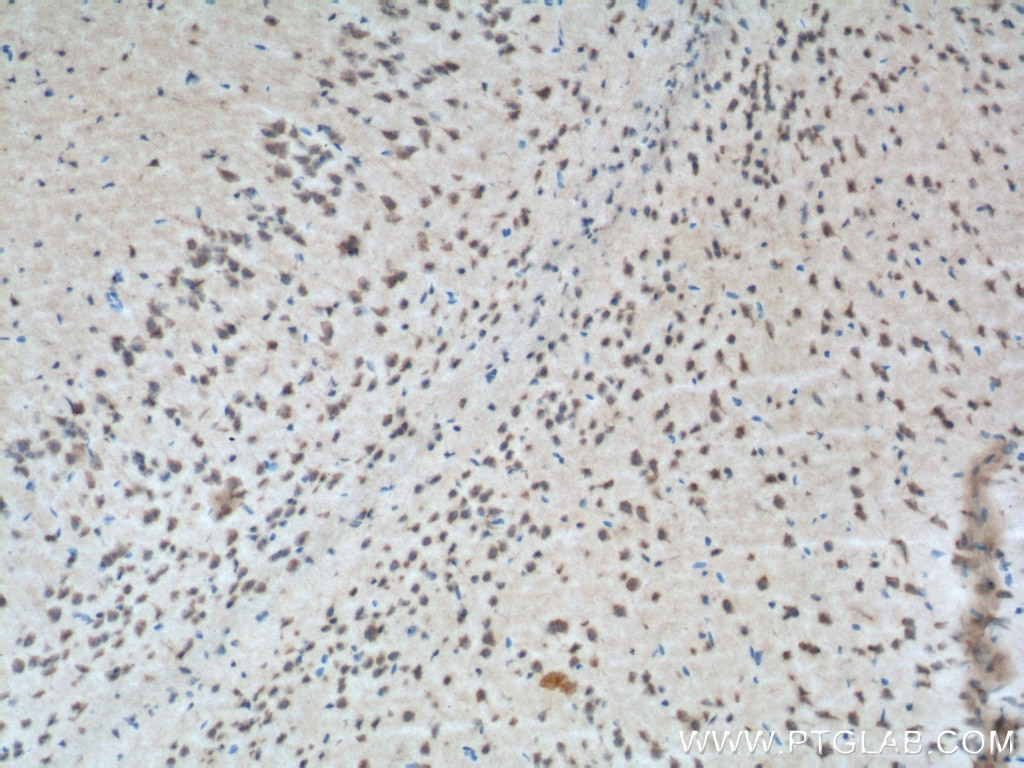 Immunohistochemistry (IHC) staining of mouse brain tissue using CXCR7 Polyclonal antibody (20423-1-AP)