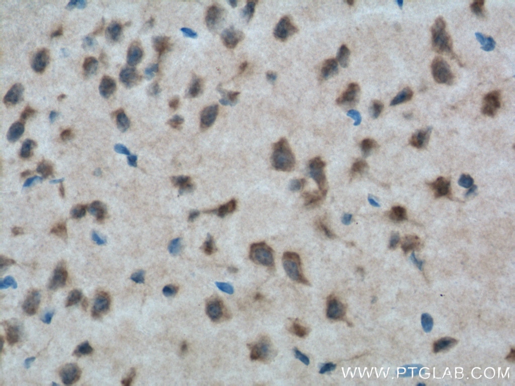 Immunohistochemistry (IHC) staining of mouse brain tissue using CXCR7 Polyclonal antibody (20423-1-AP)
