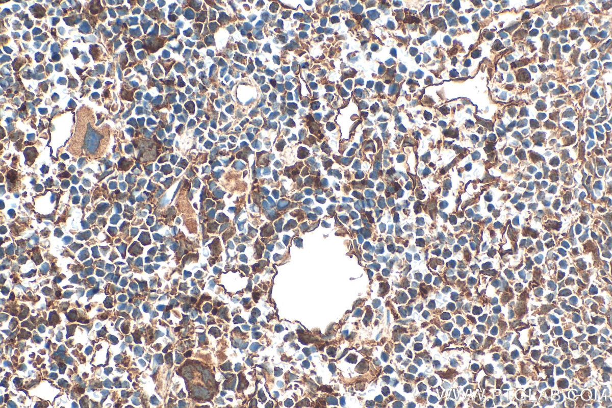 Immunohistochemistry (IHC) staining of mouse spleen tissue using CXCR7 Polyclonal antibody (20423-1-AP)