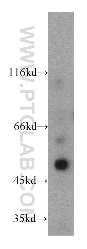 Western Blot (WB) analysis of K-562 cells using CXCR7 Polyclonal antibody (20423-1-AP)