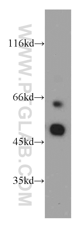 Western Blot (WB) analysis of Jurkat cells using CXCR7 Polyclonal antibody (20423-1-AP)
