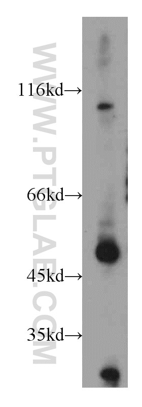 Western Blot (WB) analysis of mouse thymus tissue using CXCR7 Polyclonal antibody (20423-1-AP)