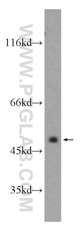 Western Blot (WB) analysis of Raji cells using CXCR7 Polyclonal antibody (20423-1-AP)
