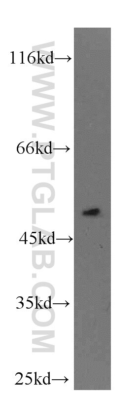 CXCR7 Polyclonal antibody