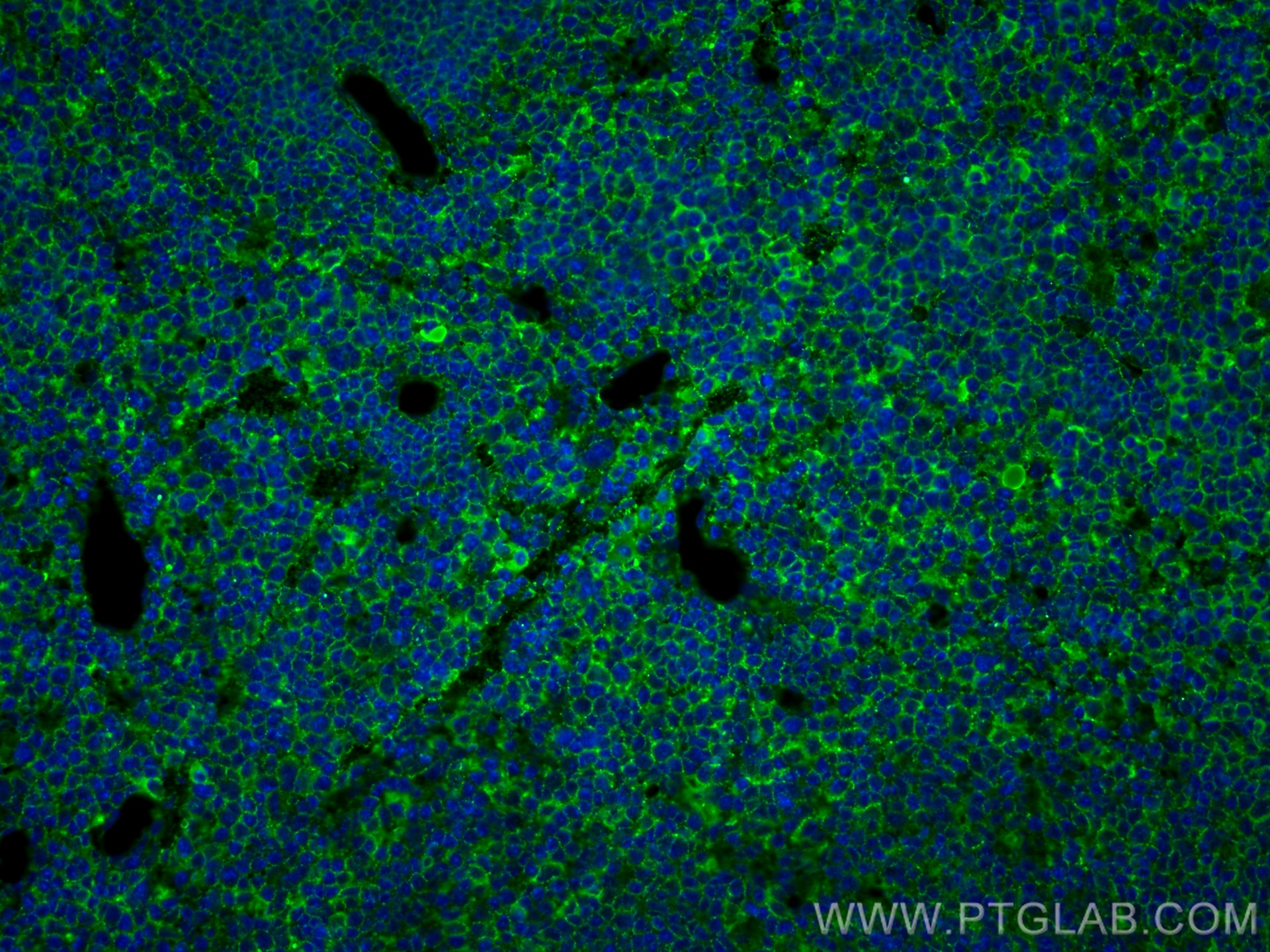 Immunofluorescence (IF) / fluorescent staining of mouse spleen tissue using CXCR7 Monoclonal antibody (60216-1-Ig)