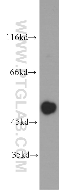 CXCR7 Monoclonal antibody