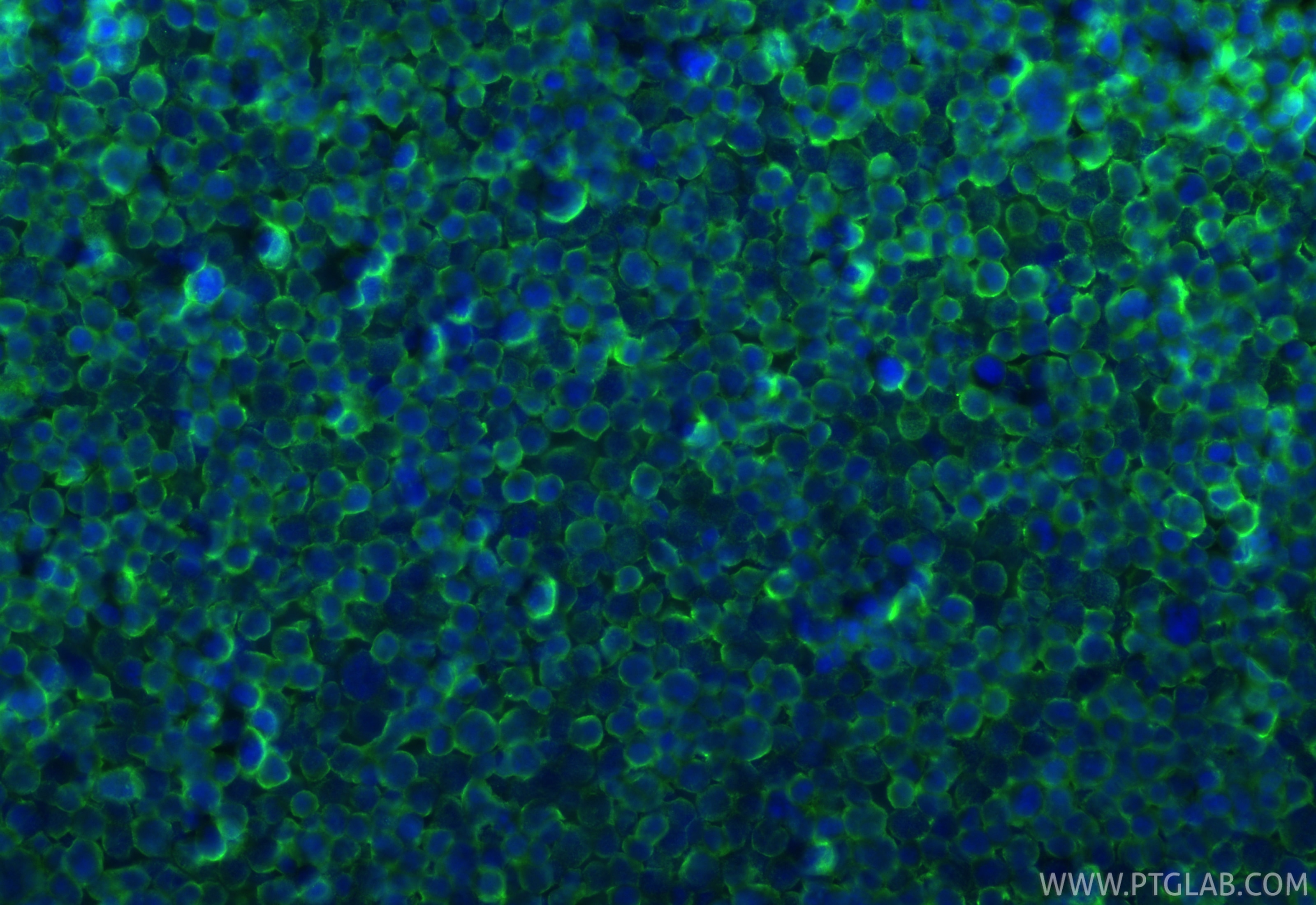 Immunofluorescence (IF) / fluorescent staining of Jurkat cells using CXCR7 Recombinant antibody (83927-1-RR)