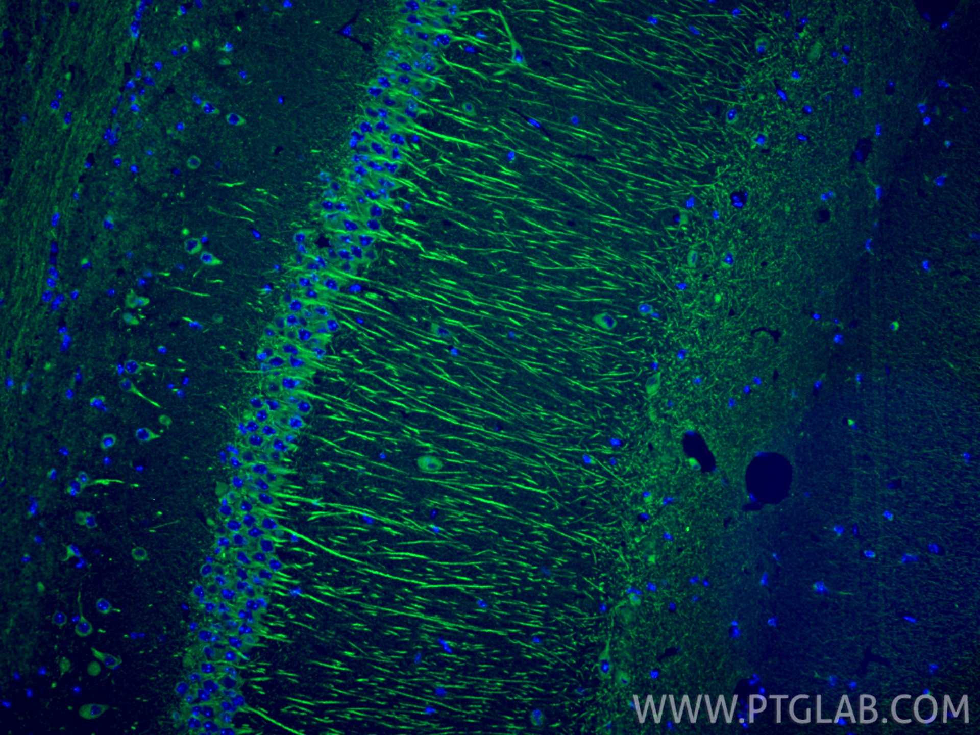 Immunofluorescence (IF) / fluorescent staining of mouse brain tissue using CXCR7 Recombinant monoclonal antibody (83927-1-RR)