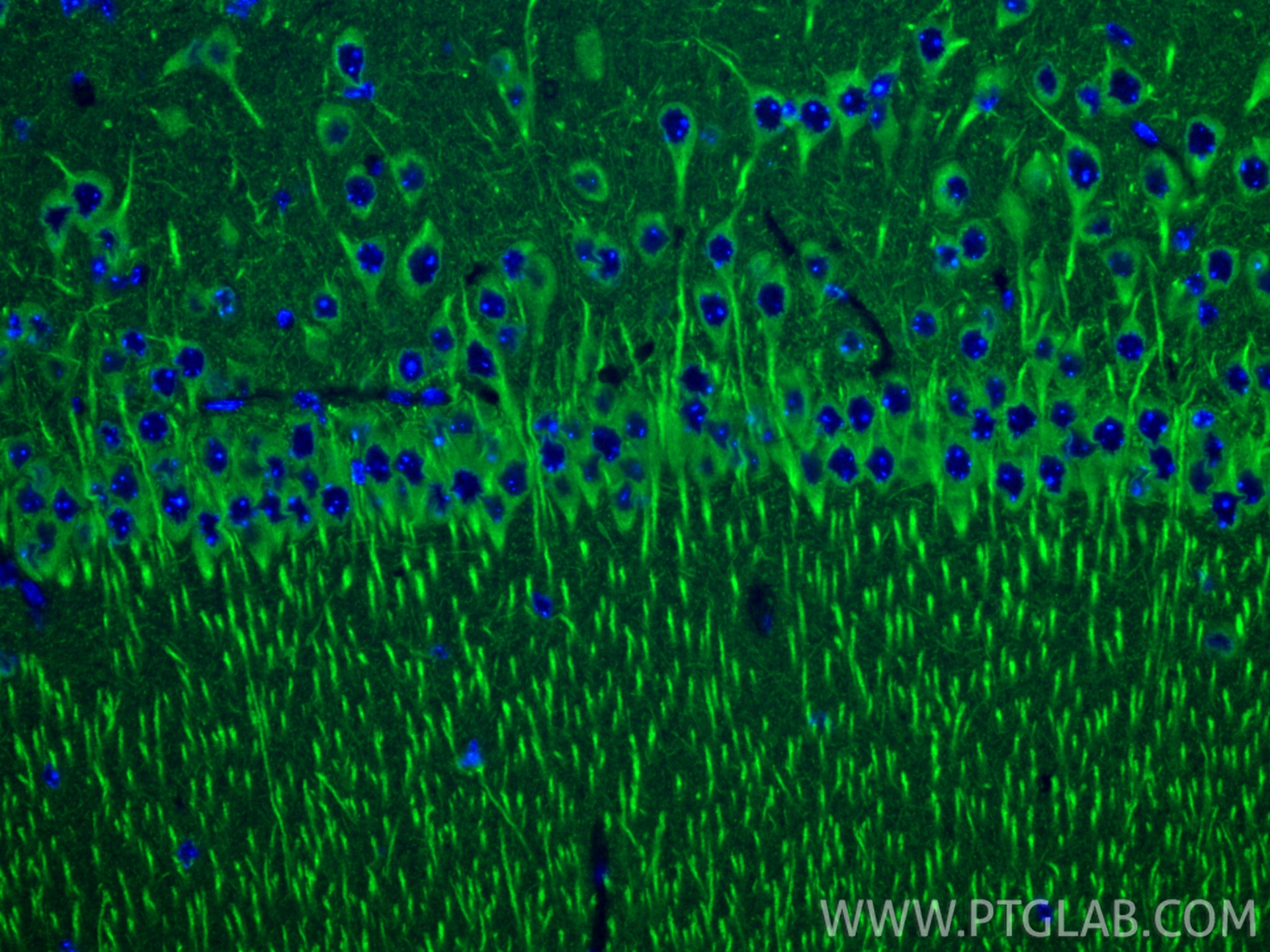 Immunofluorescence (IF) / fluorescent staining of mouse brain tissue using CXCR7 Recombinant monoclonal antibody (83927-1-RR)