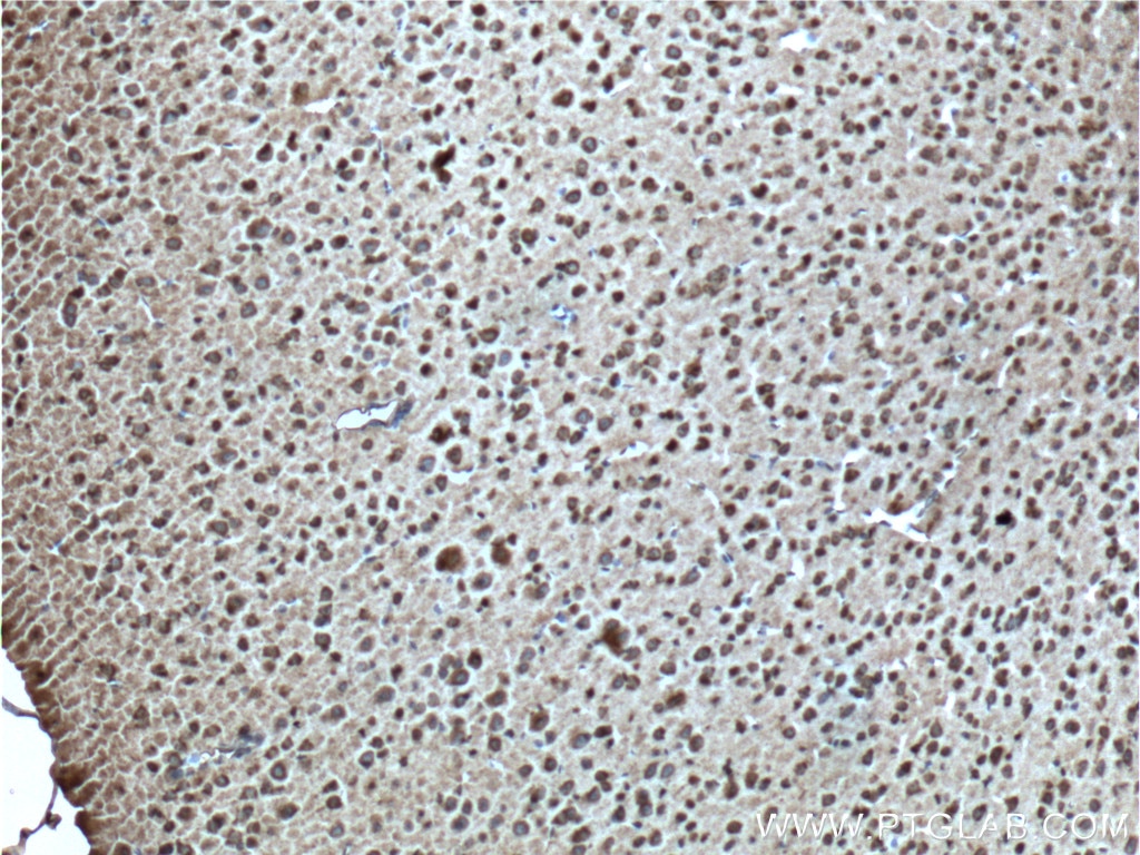 Immunohistochemistry (IHC) staining of mouse brain tissue using CXCR7-Specific Polyclonal antibody (14840-1-AP)
