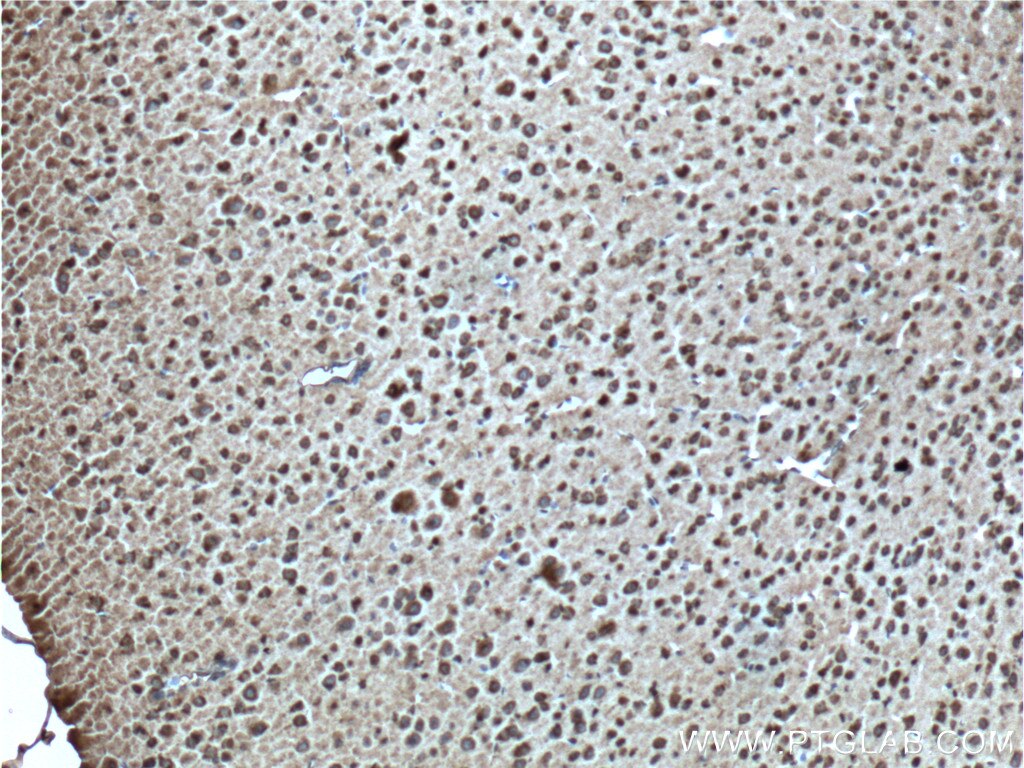 Immunohistochemistry (IHC) staining of mouse brain tissue using CXCR7-Specific Polyclonal antibody (14840-1-AP)