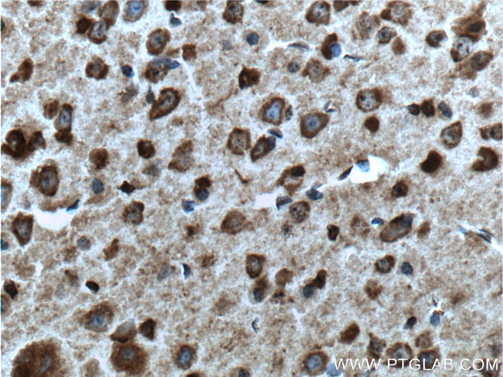 Immunohistochemistry (IHC) staining of mouse brain tissue using CXCR7-Specific Polyclonal antibody (14840-1-AP)