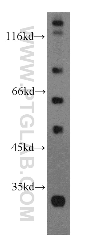 Western Blot (WB) analysis of mouse brain tissue using CXCR7-Specific Polyclonal antibody (14840-1-AP)