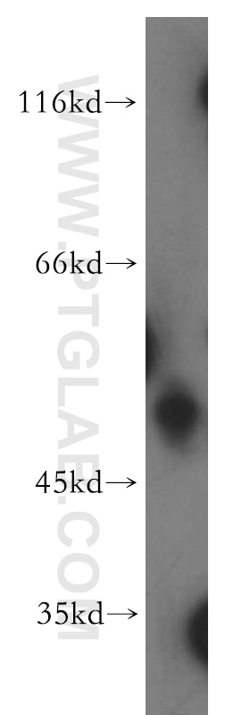 Western Blot (WB) analysis of K-562 cells using CXCR7-Specific Polyclonal antibody (14840-1-AP)