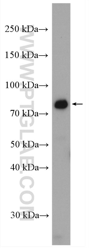 Western Blot (WB) analysis of K-562 cells using CXXC1 Polyclonal antibody (27963-1-AP)