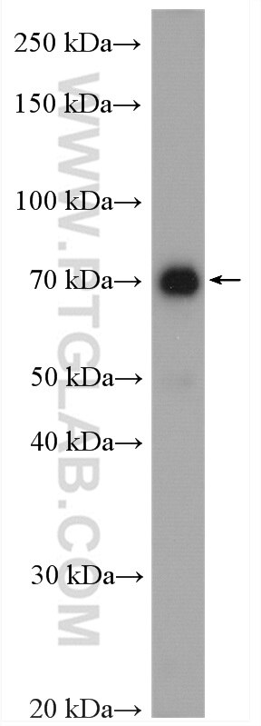 Western Blot (WB) analysis of Jurkat cells using CXXC1 Polyclonal antibody (27963-1-AP)