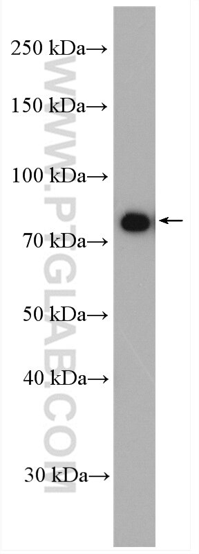 Western Blot (WB) analysis of Jurkat cells using CXXC1 Polyclonal antibody (27963-1-AP)