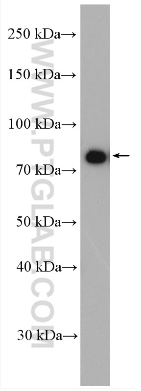 WB analysis of Jurkat using 27963-1-AP