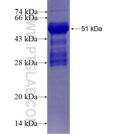CXXC1 fusion protein Ag27558 SDS-PAGE